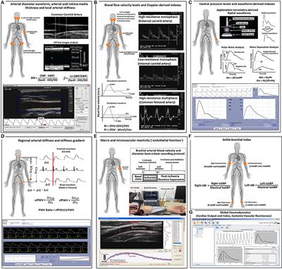 Aging-Related Moderation of the Link Between Compliance With International Physical Activity Recommendations and the Hemodynamic, Structural, and Functional Arterial Status of 3,619 Subjects Aged 3–90 Years